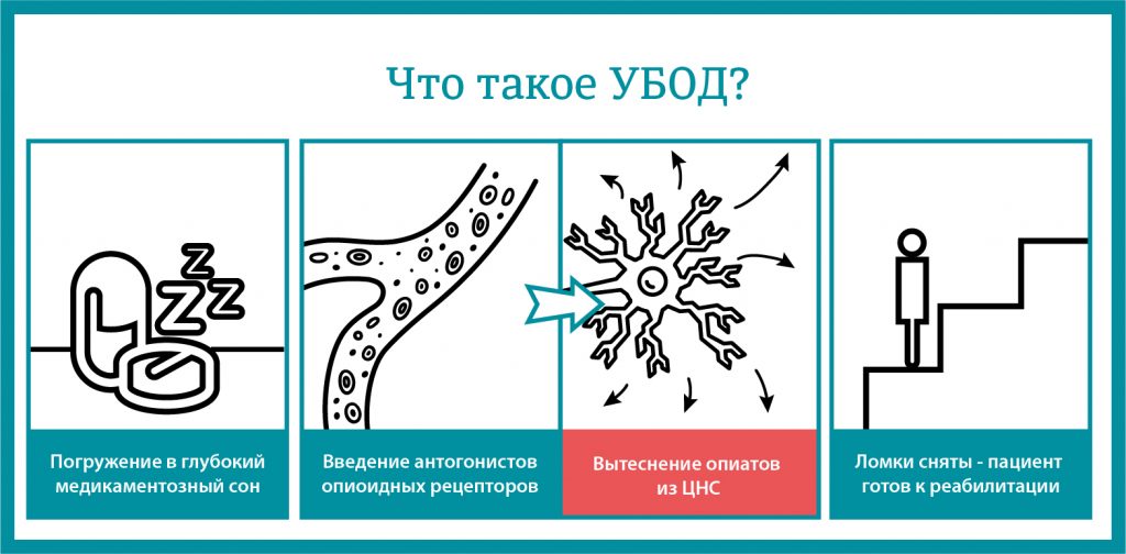 Что такое УБОД? 